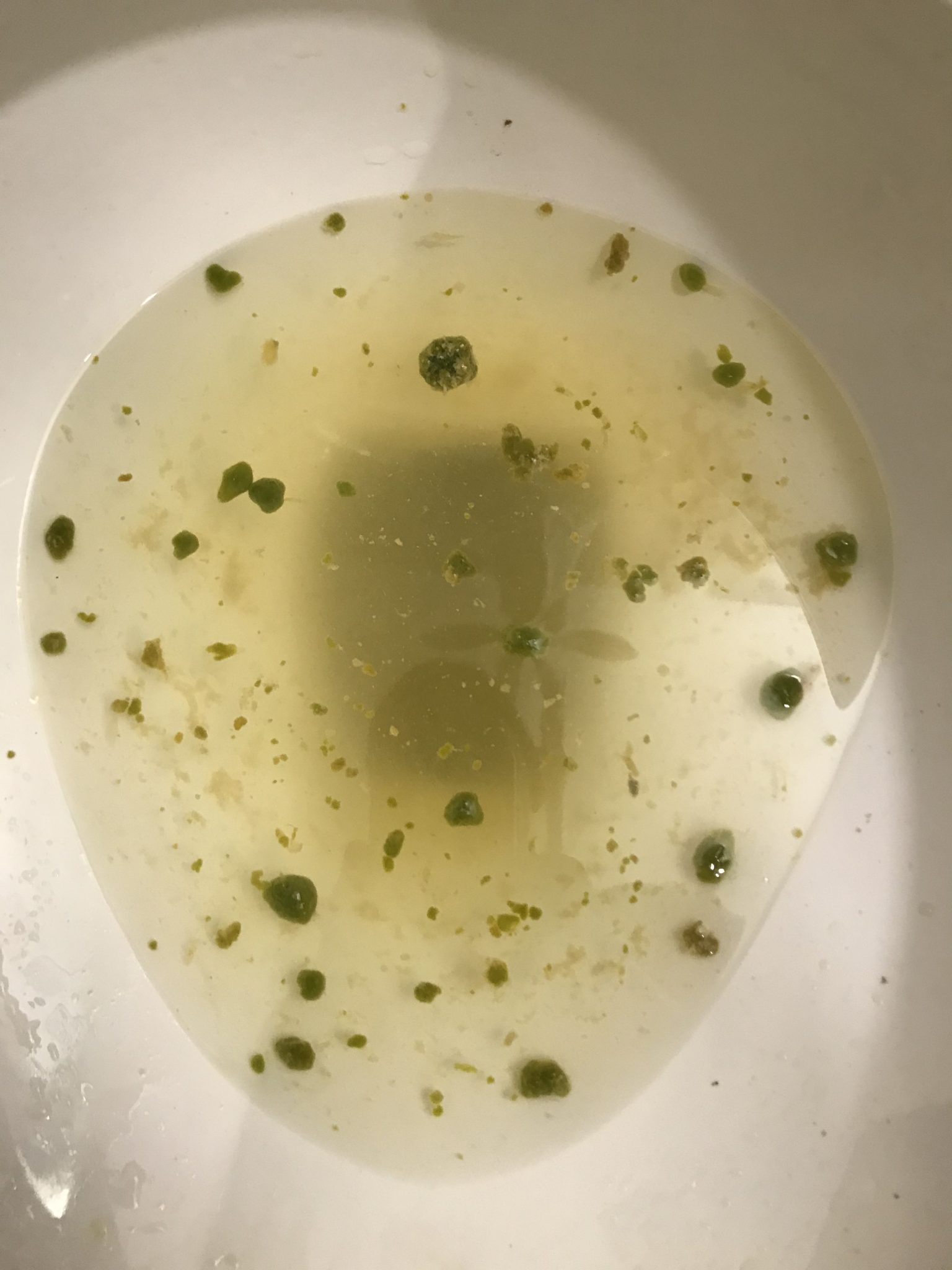 Gallbladder Stones Herbal Education Center